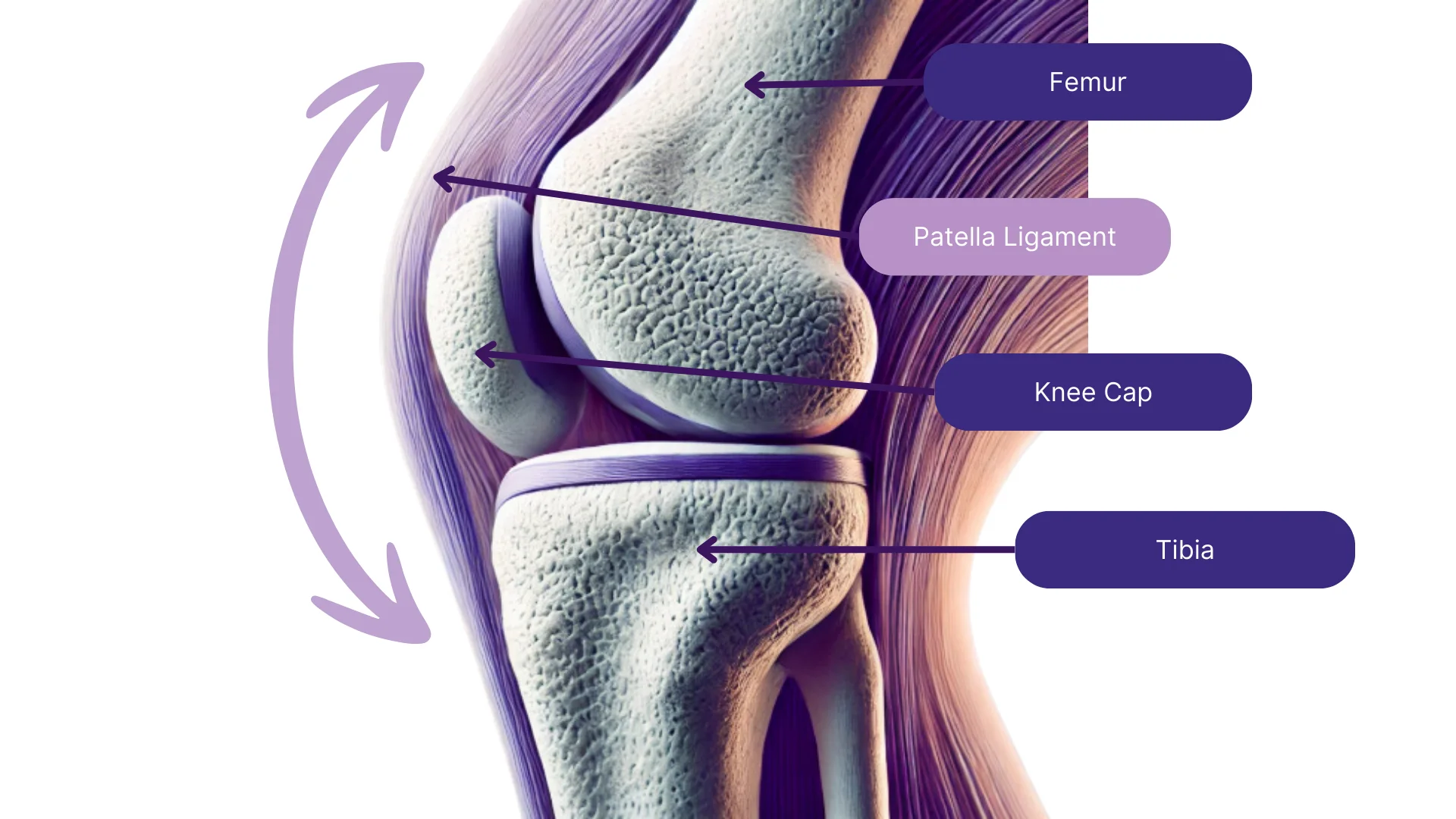 Patella Luxation