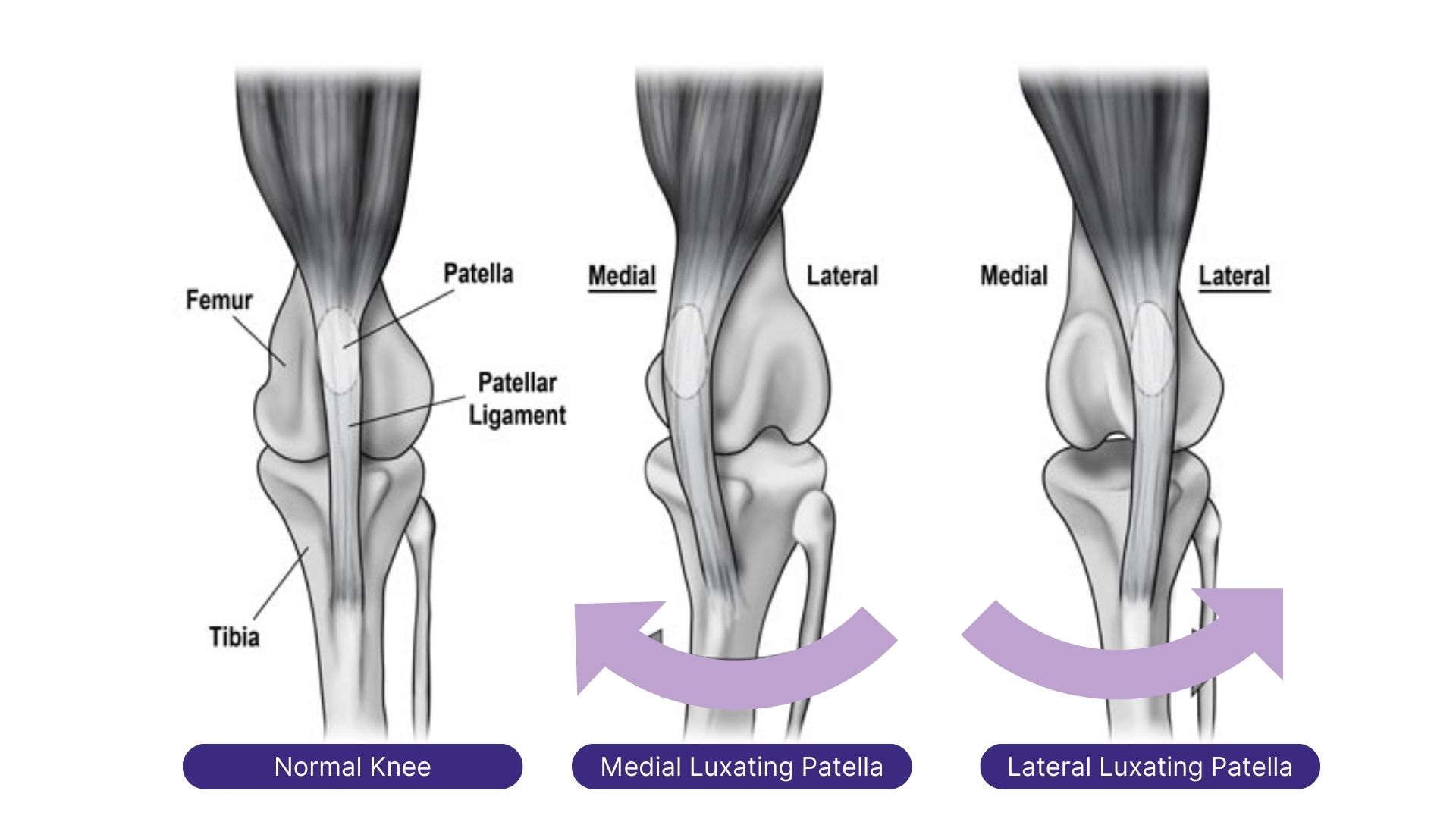 Patella luxation