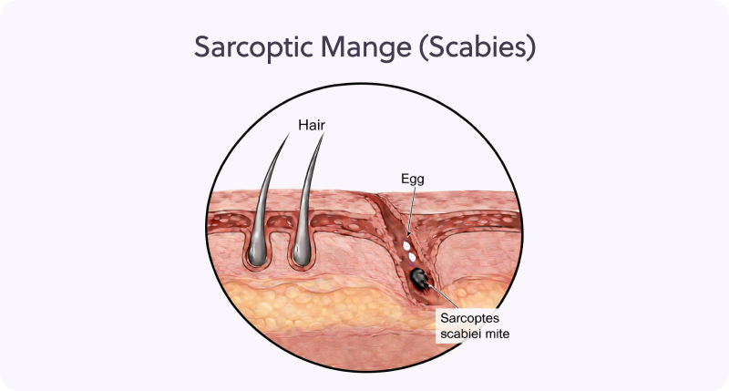 Diagram of sarcoptic mange showing a Sarcoptes scabiei mite burrowed in the skin layer, next to hair follicles and mite eggs.
